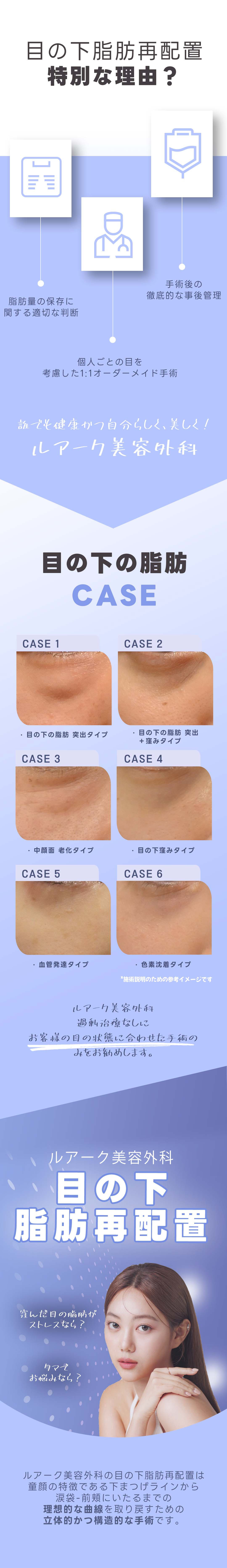 Tái phân bổ mỡ dưới mắt | Thẩm mỹ viện Ruark Apgujeong | Phẫu thuật lập thể cải thiện quầng thâm và chảy xệ