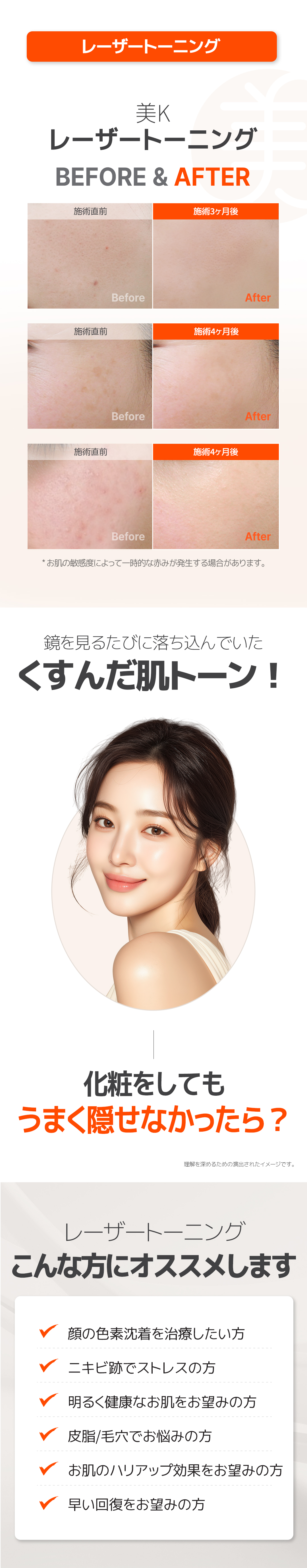 Laser Toning & Fraxel tại Phòng khám Mi K gần ga Gangnam | Cải thiện đốm nám, xỉn màu và lỗ chân lông