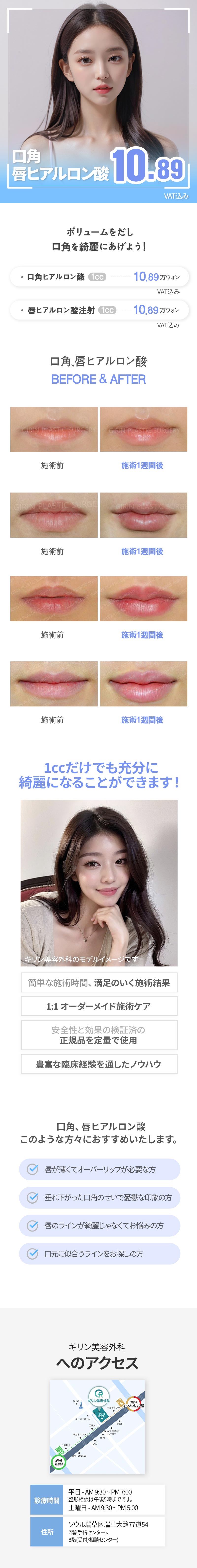 Tiêm Hyaluronic Acid khóe miệng・môi hướng đến môi đẹp tự nhiên｜Bắt đầu thẩm mỹ Hàn Quốc từ 1cc｜Phẫu thuật Thẩm mỹ Girin Seoul Sinnonhyeon