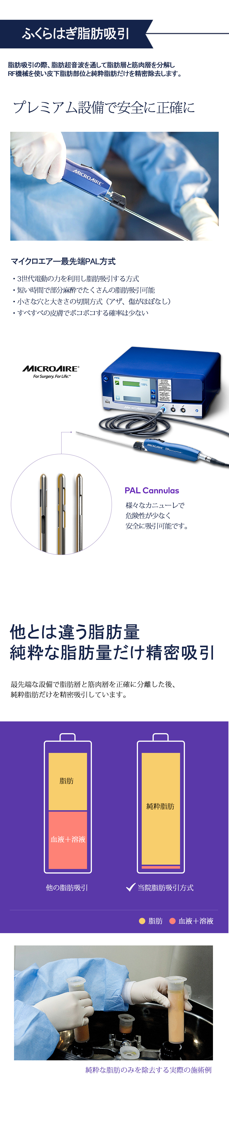 Hút mỡ bắp chân và phẫu thuật cắt đứt thần kinh hướng đến đường chân đẹp | WIZ&MI Clinic | Seoul Myeongdong