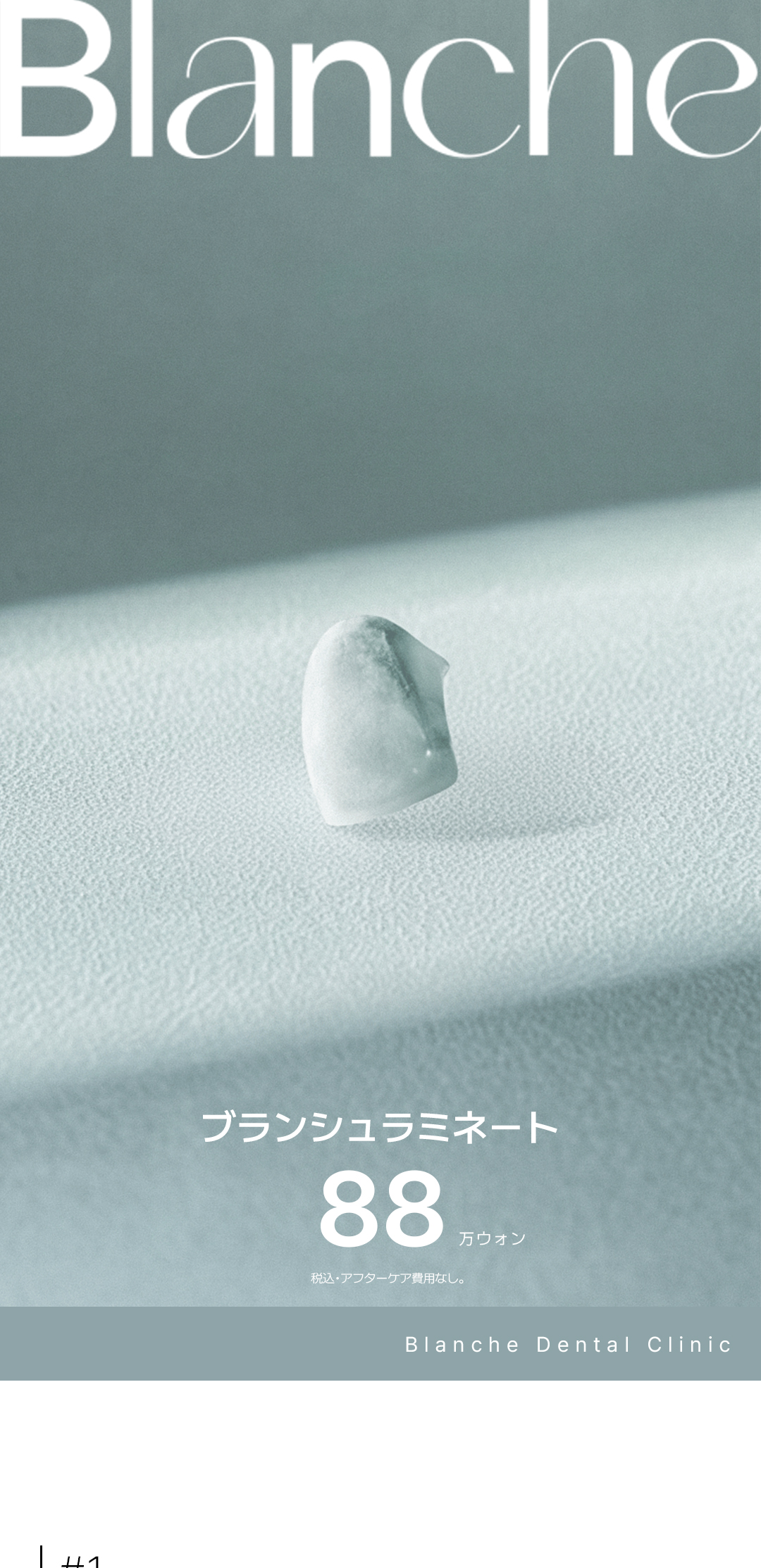 Laminate không mài | Blanche Dental | Hướng tới răng trắng tự nhiên với Veneer siêu mỏng 0,01mm | Seoul Gangnam