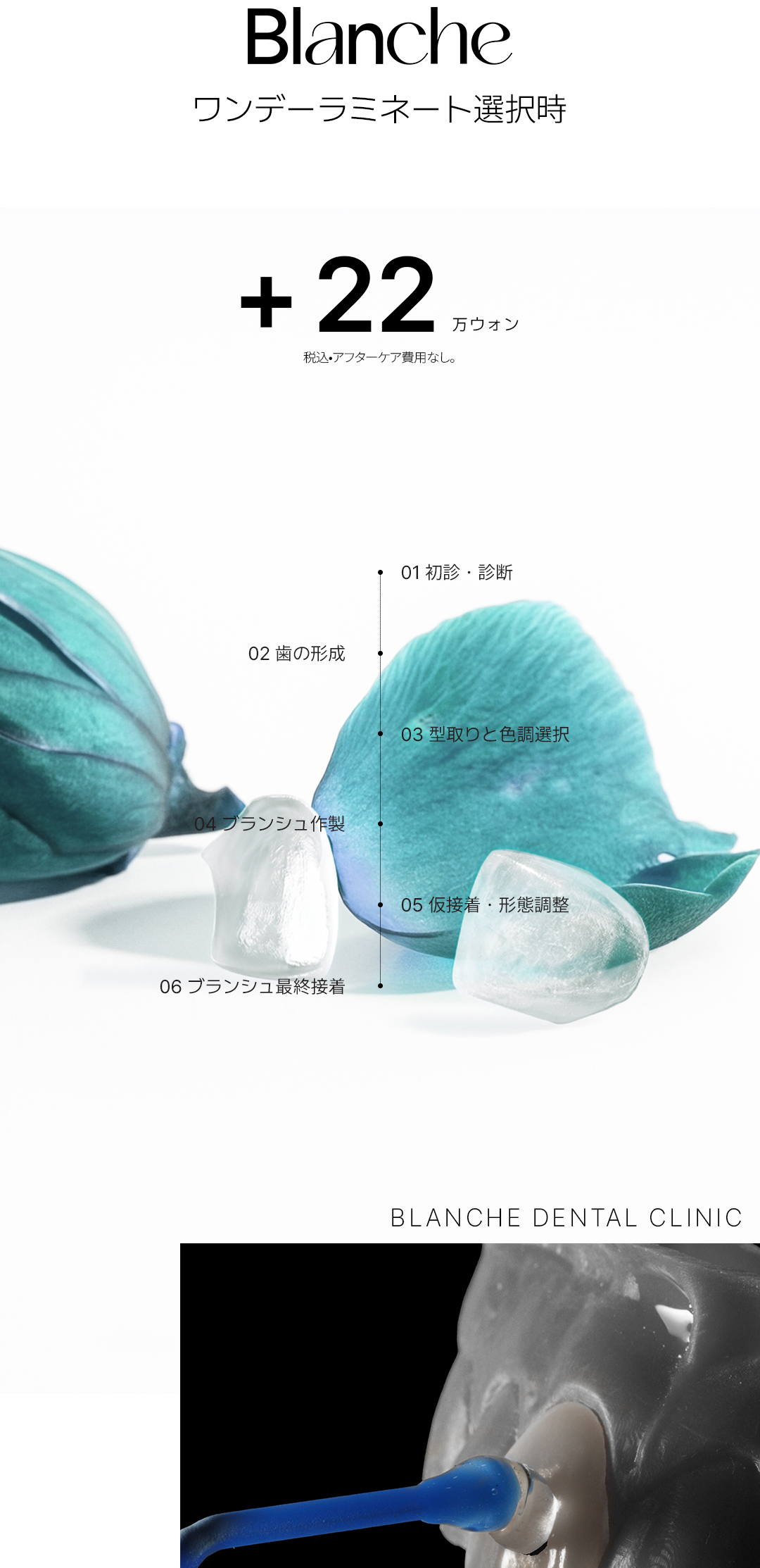 Laminate không mài | Blanche Dental | Hướng tới răng trắng tự nhiên với Veneer siêu mỏng 0,01mm | Seoul Gangnam