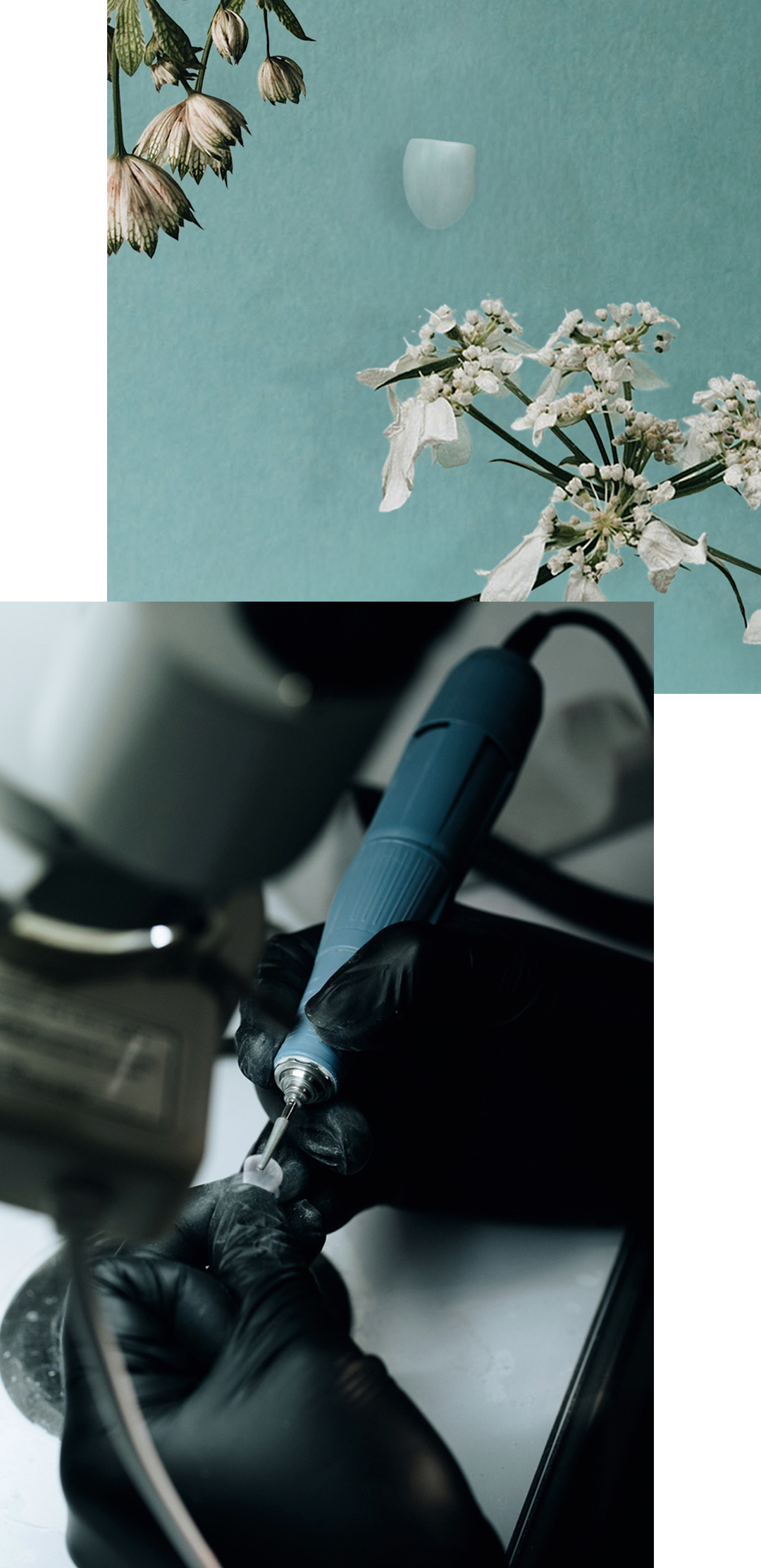 Laminate không mài | Blanche Dental | Hướng tới răng trắng tự nhiên với Veneer siêu mỏng 0,01mm | Seoul Gangnam