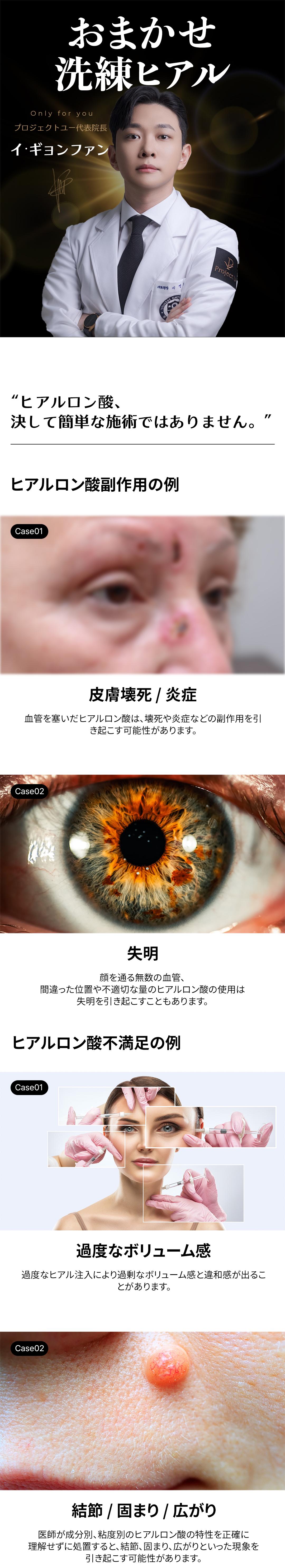 Thủ thuật Hyaluronic Acid tùy chỉnh tại Project You Clinic Hongdae, Seoul Hàn Quốc | Điều trị filler 1:1 bằng chẩn đoán chính xác 3D x viện trưởng đại diện