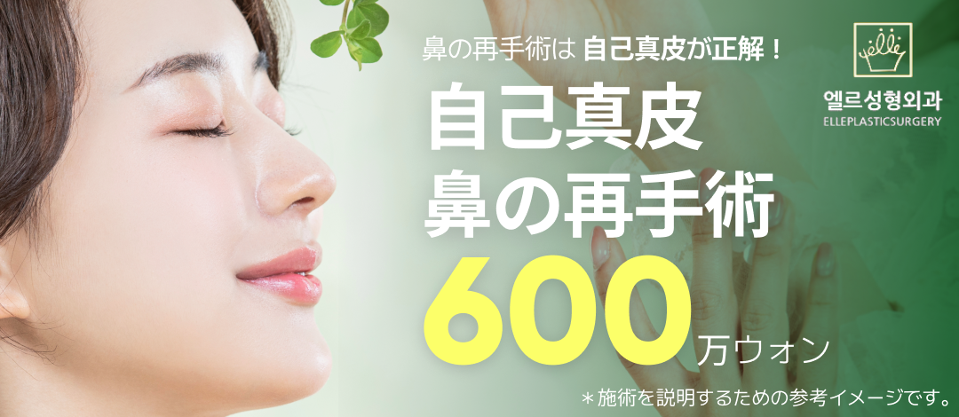 Phẫu thuật lại mũi da tự thân | Phẫu thuật chỉnh sửa an toàn sau loại bỏ túi độn | Bác sĩ đăng bài SCI tại viện | L Phẫu thuật Thẩm mỹ