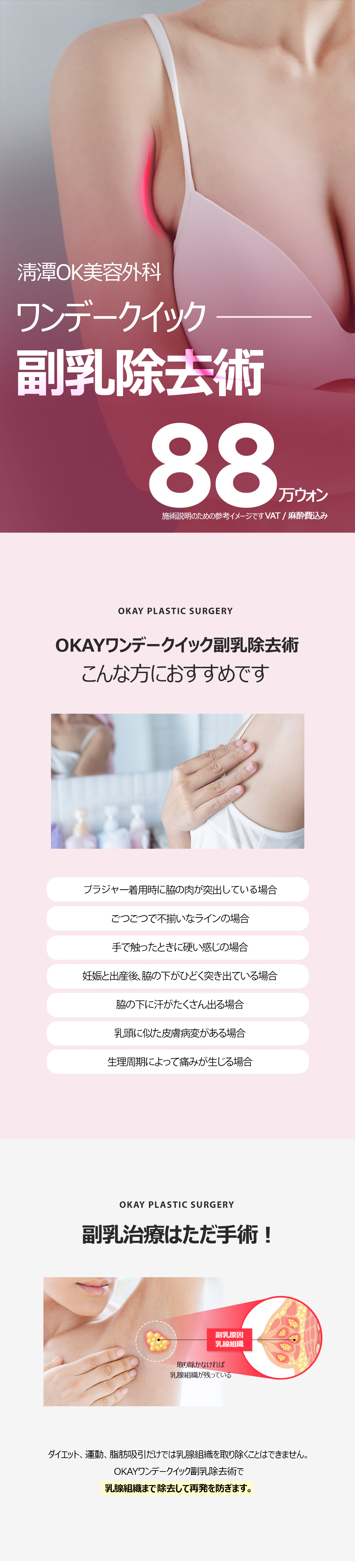 Phẫu thuật loại bỏ nách phụ Quick One Day | Liệu trình trong ngày hướng đến cải thiện đường nách | Cheongdam OK Thẩm mỹ Ngoại khoa