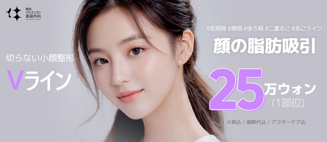 Hút mỡ mặt V-line nhằm V-line | Tạo hình khuôn mặt không dao từ 250.000 won | Ilgongong Plastic Surgery | Ga Apgujeong