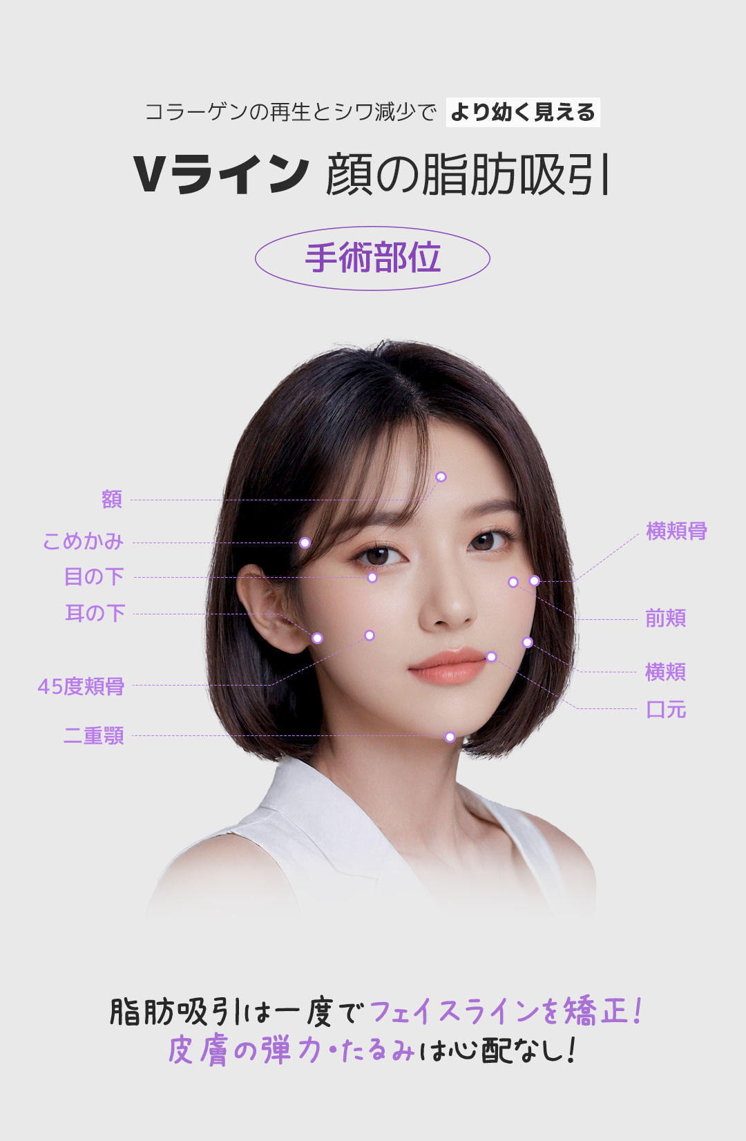 Hút mỡ mặt V-line nhằm V-line | Tạo hình khuôn mặt không dao từ 250.000 won | Ilgongong Plastic Surgery | Ga Apgujeong