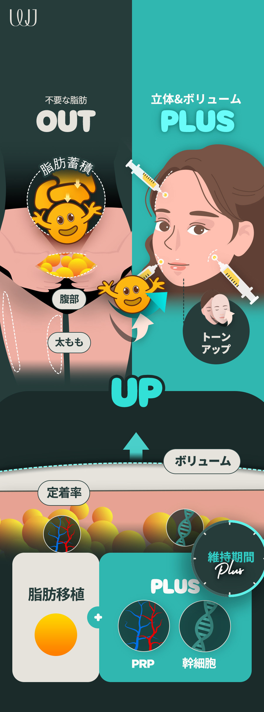 Ghép mỡ toàn mặt phục hồi volume｜PRP tế bào gốc nâng cao tỷ lệ sống sót｜Hàn Quốc Seoul Gangnam WJ Wonjin Plastic Surgery