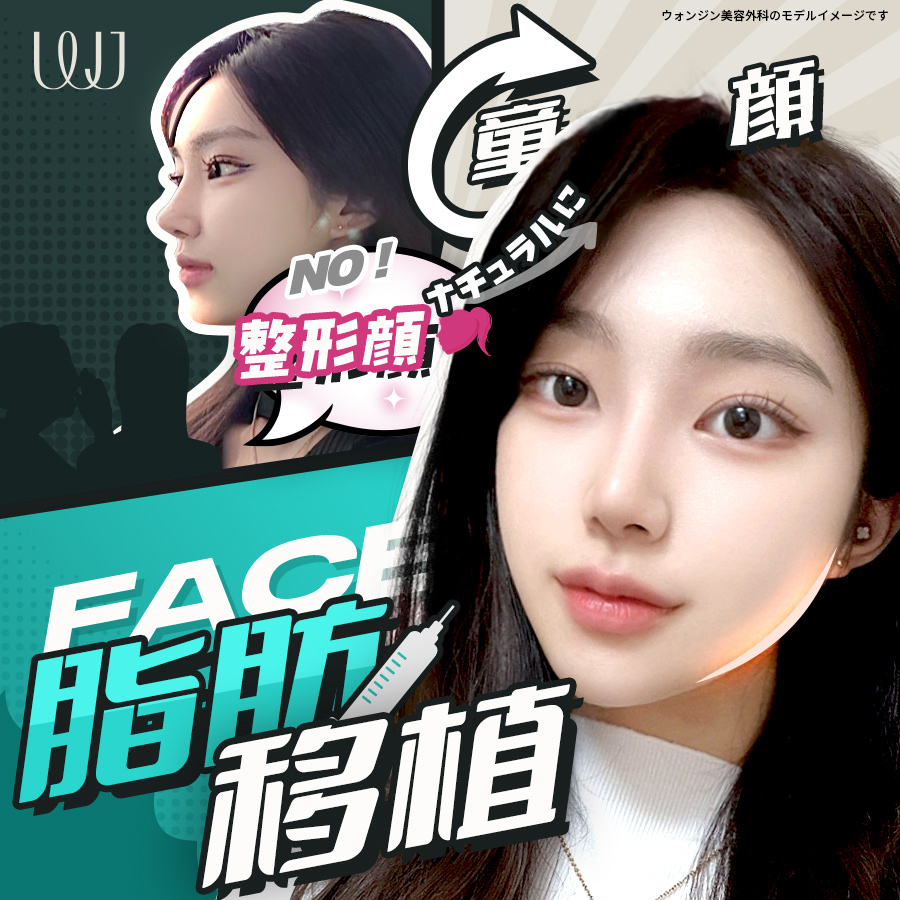 Ghép mỡ toàn mặt phục hồi volume｜PRP tế bào gốc nâng cao tỷ lệ sống sót｜Hàn Quốc Seoul Gangnam WJ Wonjin Plastic Surgery