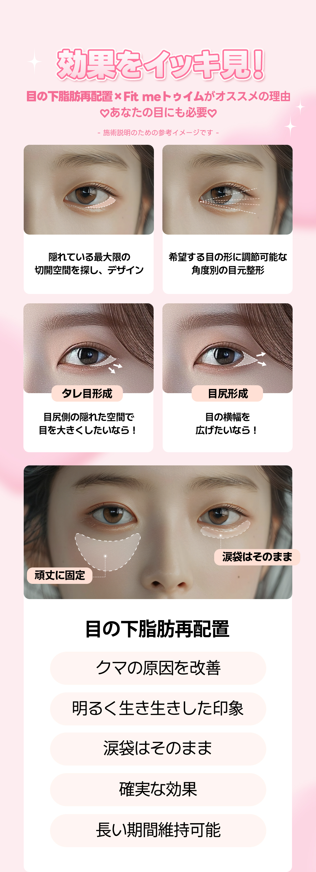 Tái phân bổ mỡ dưới mắt + tạo mắt đuôi cá đồng thời cho vùng mắt trẻ trung | Thẩm mỹ viện TOBE Gangnam Sinsa