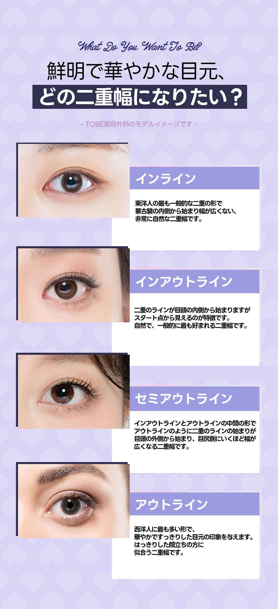 Phẫu thuật mắt All in One của TOBE Plastic Surgery | Phương pháp dính tự nhiên + Cắt vùng mắt nhằm vùng mắt lý tưởng | Ga Sinsa, Seoul