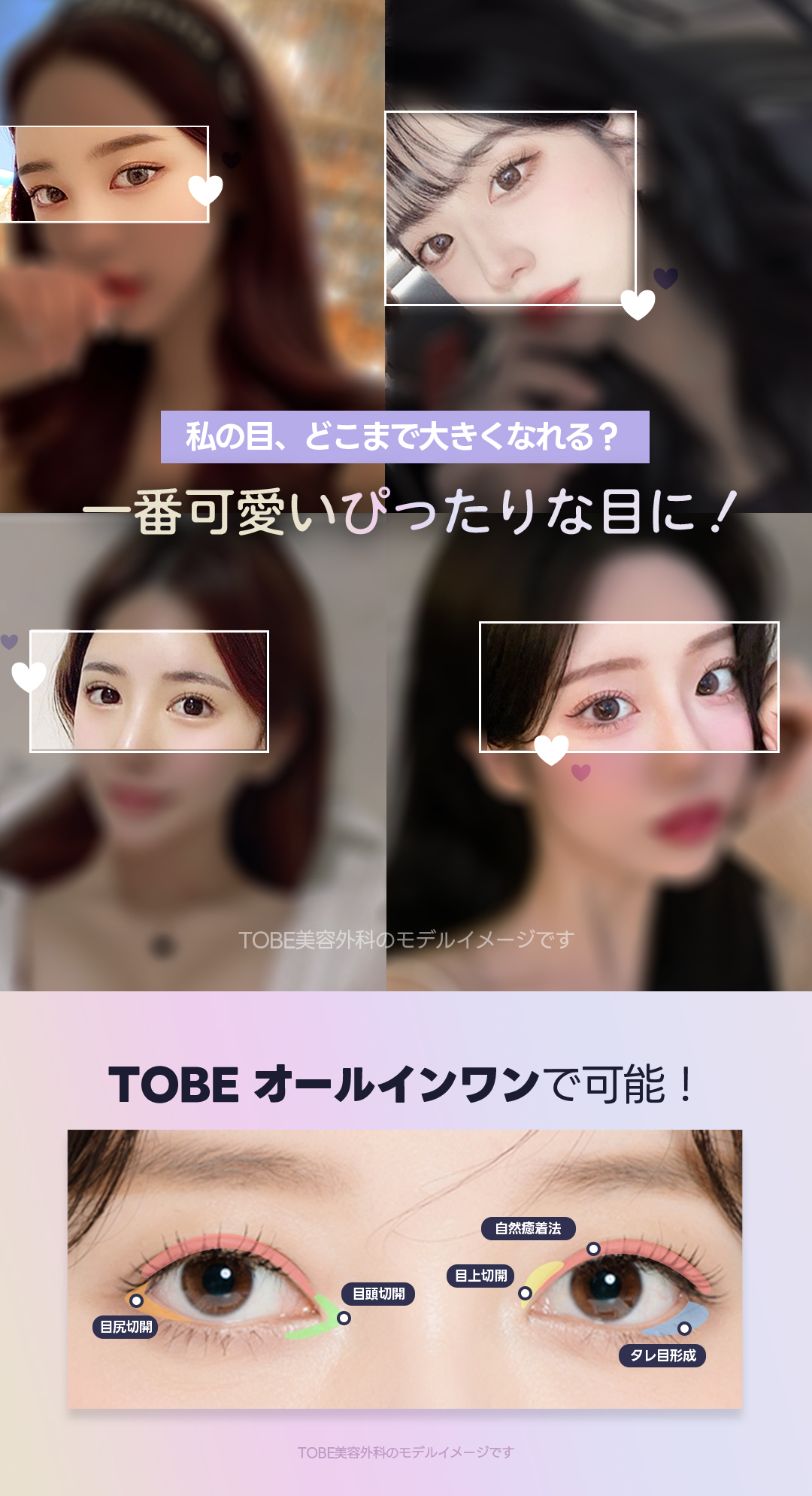 Phẫu thuật mắt All in One của TOBE Plastic Surgery | Phương pháp dính tự nhiên + Cắt vùng mắt nhằm vùng mắt lý tưởng | Ga Sinsa, Seoul