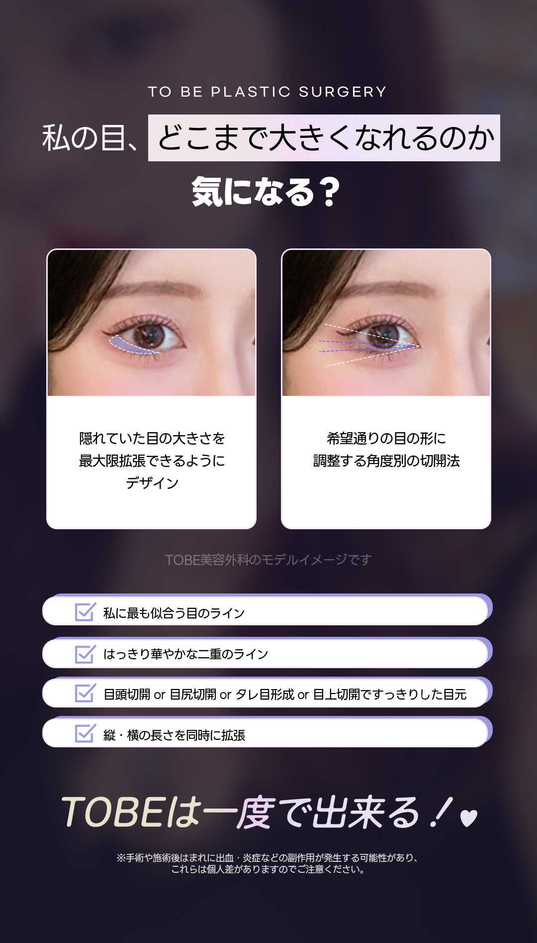 Phẫu thuật mắt All in One của TOBE Plastic Surgery | Phương pháp dính tự nhiên + Cắt vùng mắt nhằm vùng mắt lý tưởng | Ga Sinsa, Seoul