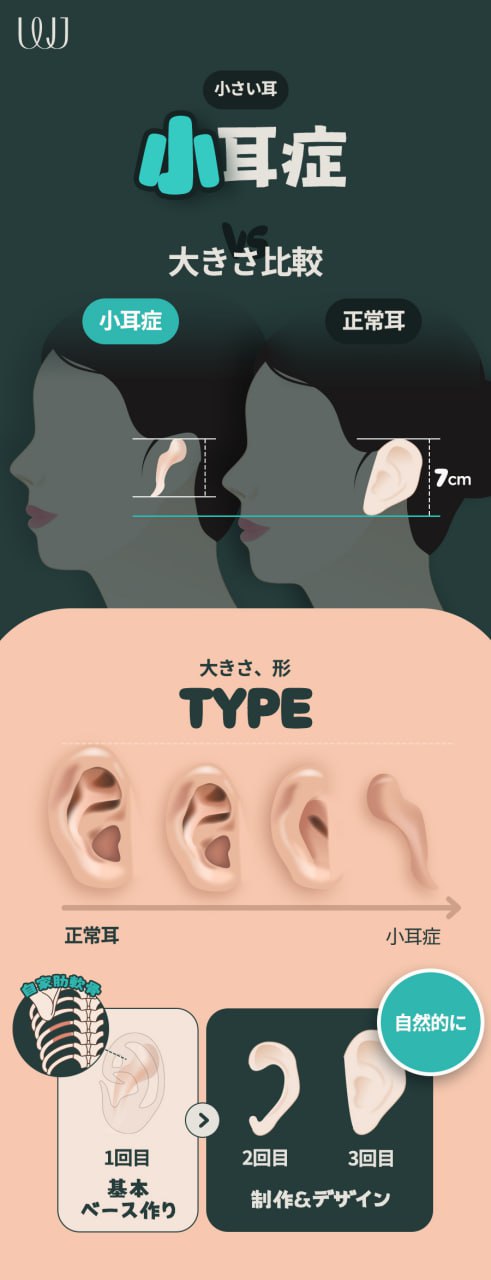 Tạo hình tai lý tưởng | Liệu pháp đáp ứng nhiều vấn đề tai như tai vểnh, tai gấp, tiểu nhĩ