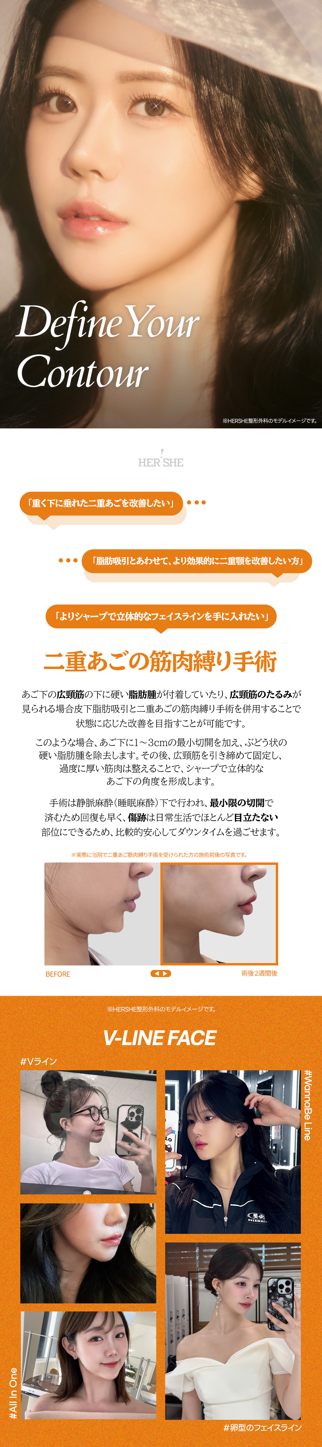 Buộc cơ nọng cằm và hút mỡ | HERSHE mở cửa năm 1992 | Tạo hình contour Cheongdam
