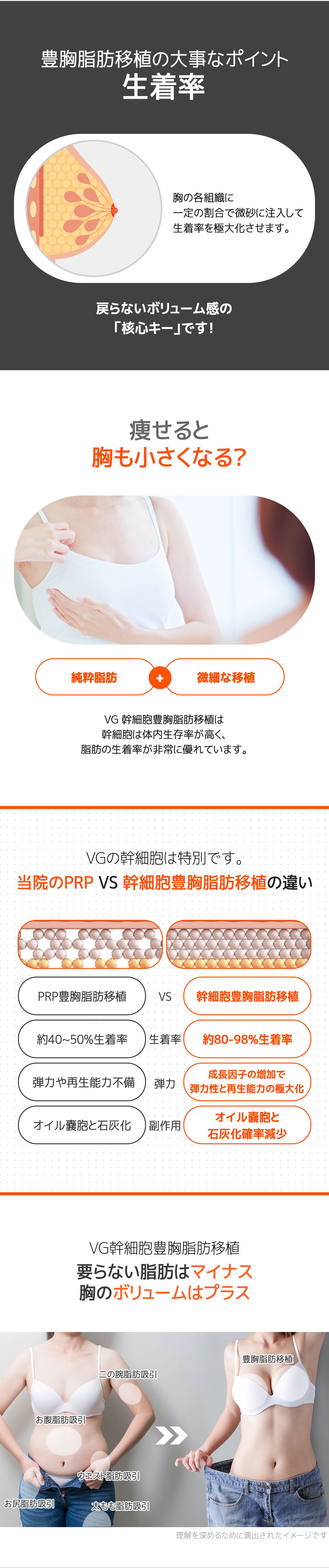 Seoul Gangnam・Nâng ngực bằng mỡ tế bào gốc hướng tới vòng một tự nhiên｜Very Good Plastic Surgery