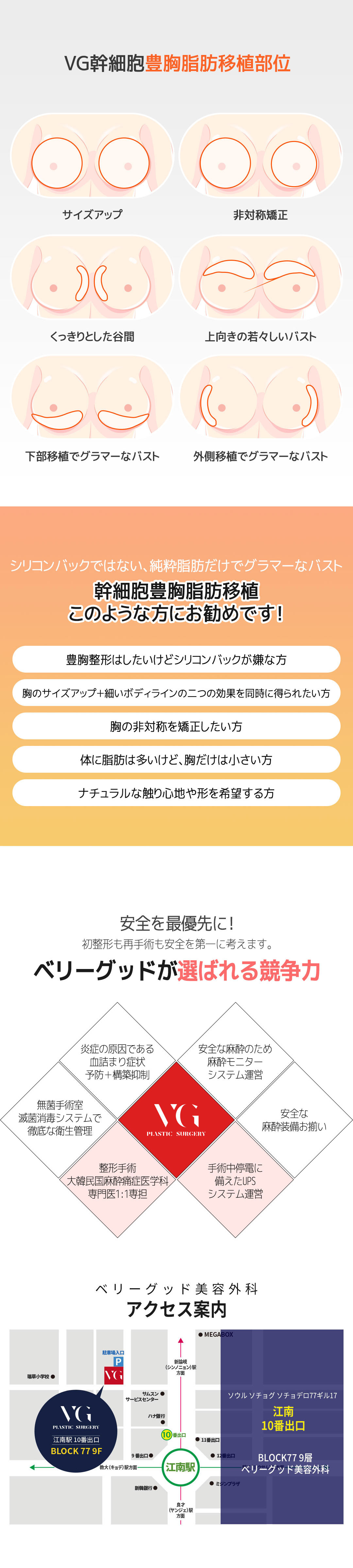 Seoul Gangnam・Nâng ngực bằng mỡ tế bào gốc hướng tới vòng một tự nhiên｜Very Good Plastic Surgery