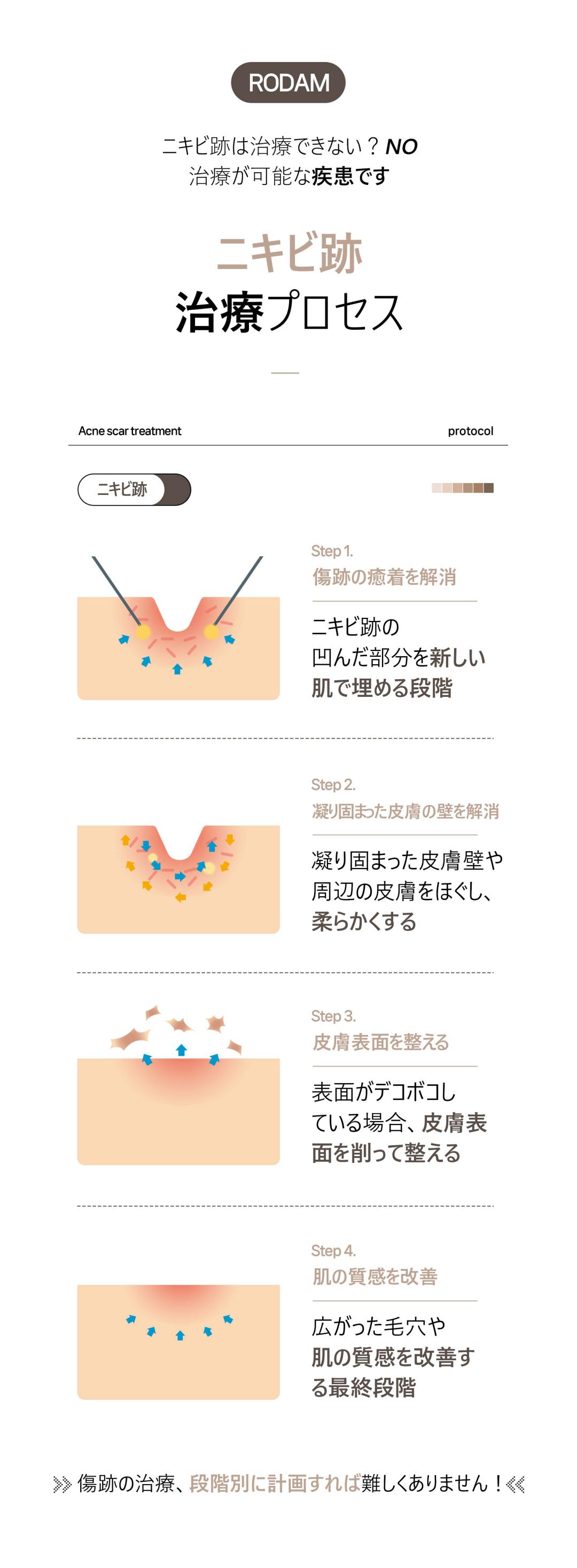 Điều trị sẹo mụn và sẹo rỗ Colatherapy lần đầu 5,413 yên | Liệu trình chuyên về sẹo được cấp bằng sáng chế | Rodam Hàn y viện Busan