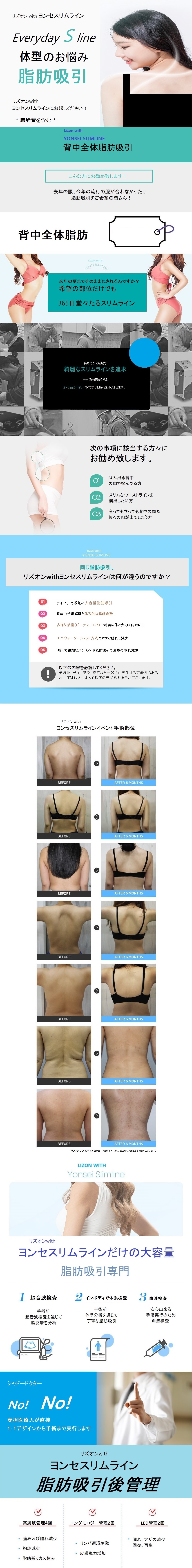 Hút mỡ toàn bộ lưng｜Rạch nhỏ 2-3mm hướng tới giảm sưng｜Lison with Yonsei Slimline