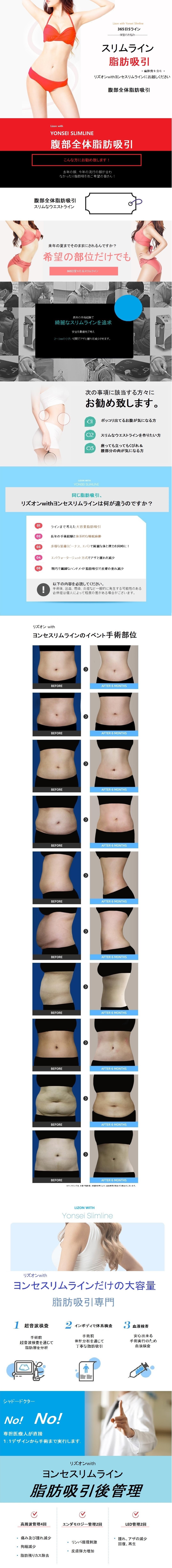 【Hàn Quốc Apgujeong】Hút mỡ toàn bộ vùng bụng｜Bao gồm phí gây mê 367,979 yên｜Lison With Yonsei Slimline