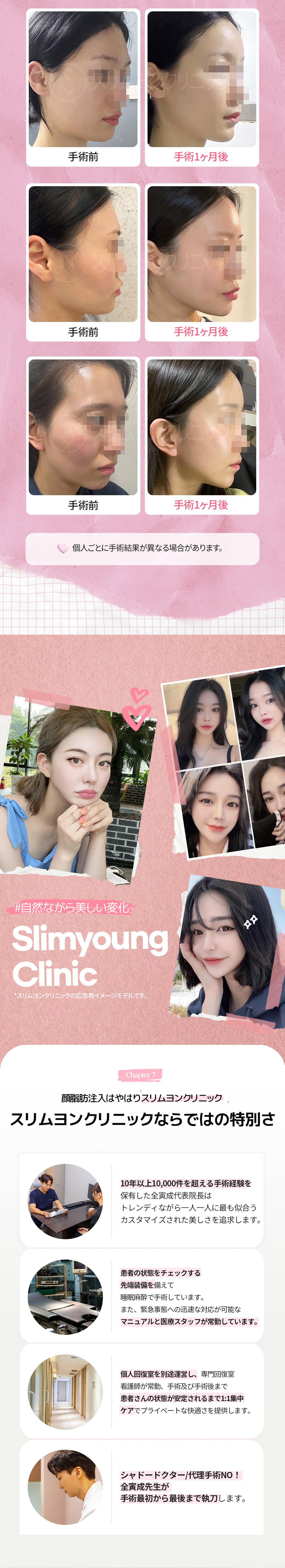 Ghép mỡ mặt｜Seoul Myeongdong Slim Yong Clinic｜Thủ thuật tùy chỉnh hướng tới cải thiện volume tự nhiên