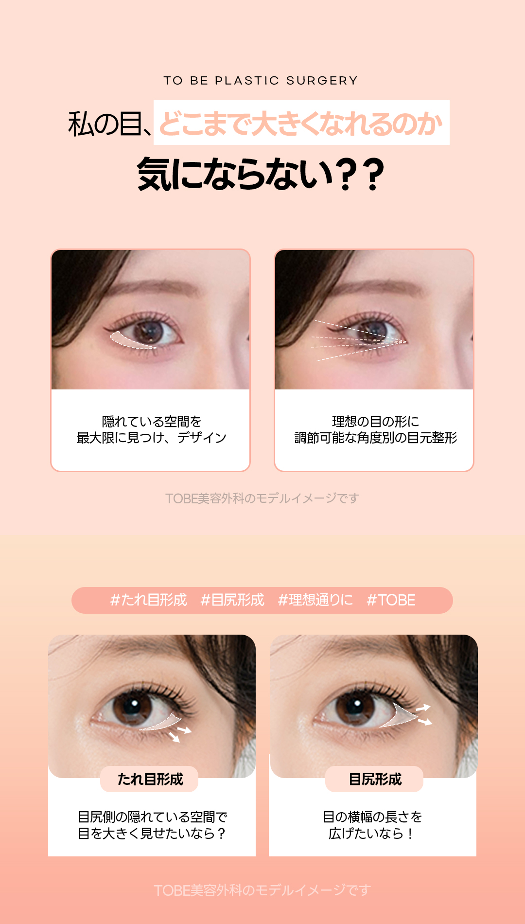 Dual Tuim không cắt (đuôi mắt + tạo hình mắt xệ) mở rộng mắt tự nhiên | TOBE Plastic Surgery【Ga Gangnam Sinsa】