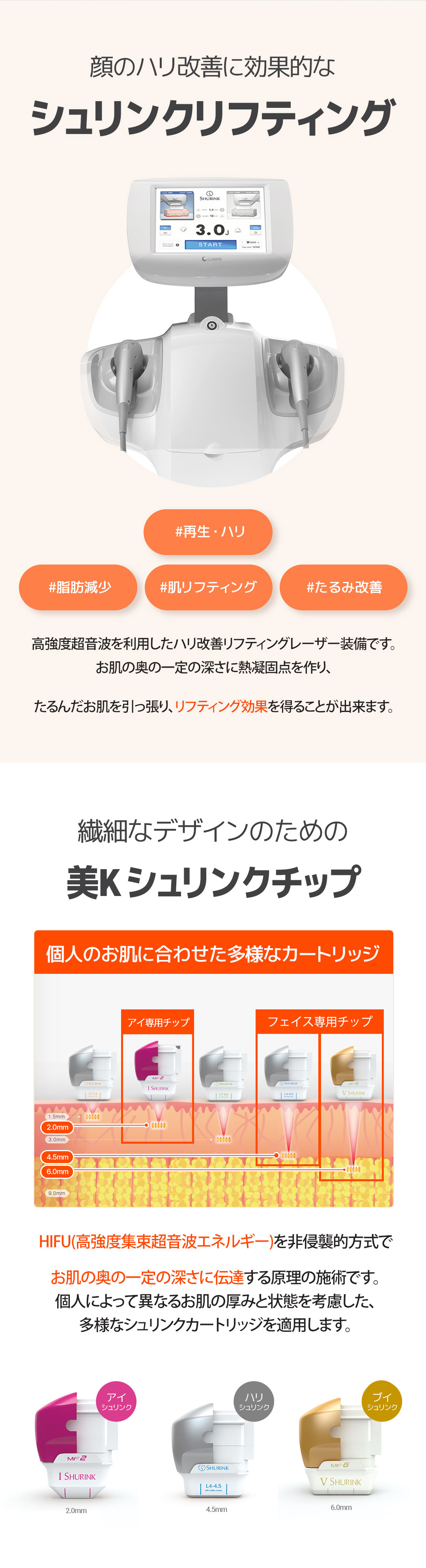 Shrink 300 Shot ga Gangnam Hàn Quốc | Thủ thuật nhằm cải thiện độ căng và tạo V-line tại Mi K Clinic