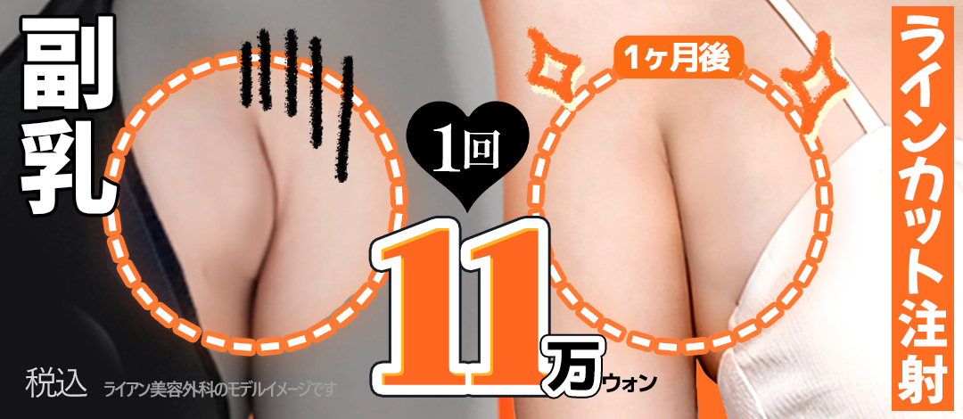 Tiêm tan mỡ vú phụ tạo đường viền tay gọn gàng｜Tiêm Line Cut hướng tới thân hình hợp với áo hai dây｜Ryan Plastic Surgery