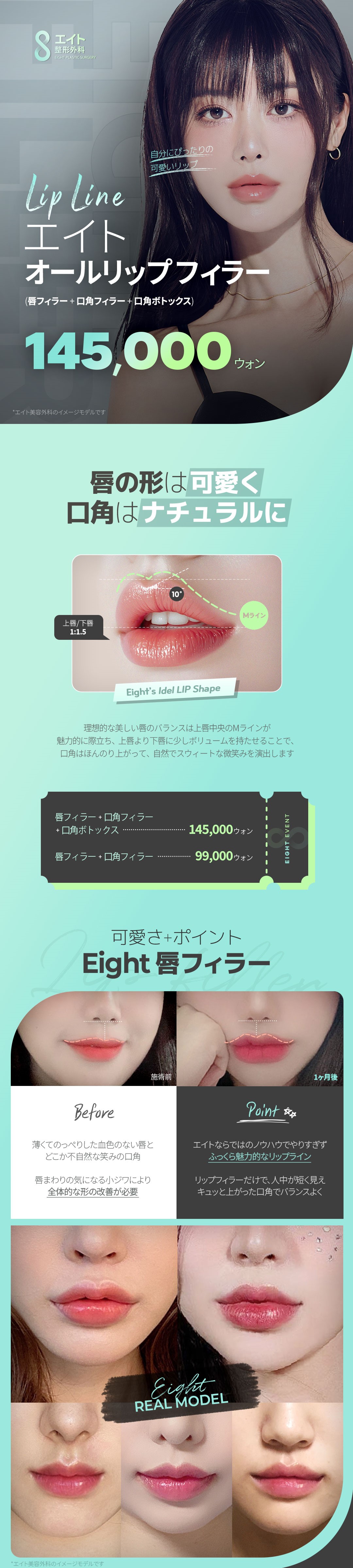 All Lip Filler Phẫu thuật Thẩm mỹ Eight Hàn Quốc｜Chăm sóc toàn diện môi + khóe miệng + Botox hướng đến đường môi lý tưởng｜Cách ga Apgujeong 5 phút đi bộ