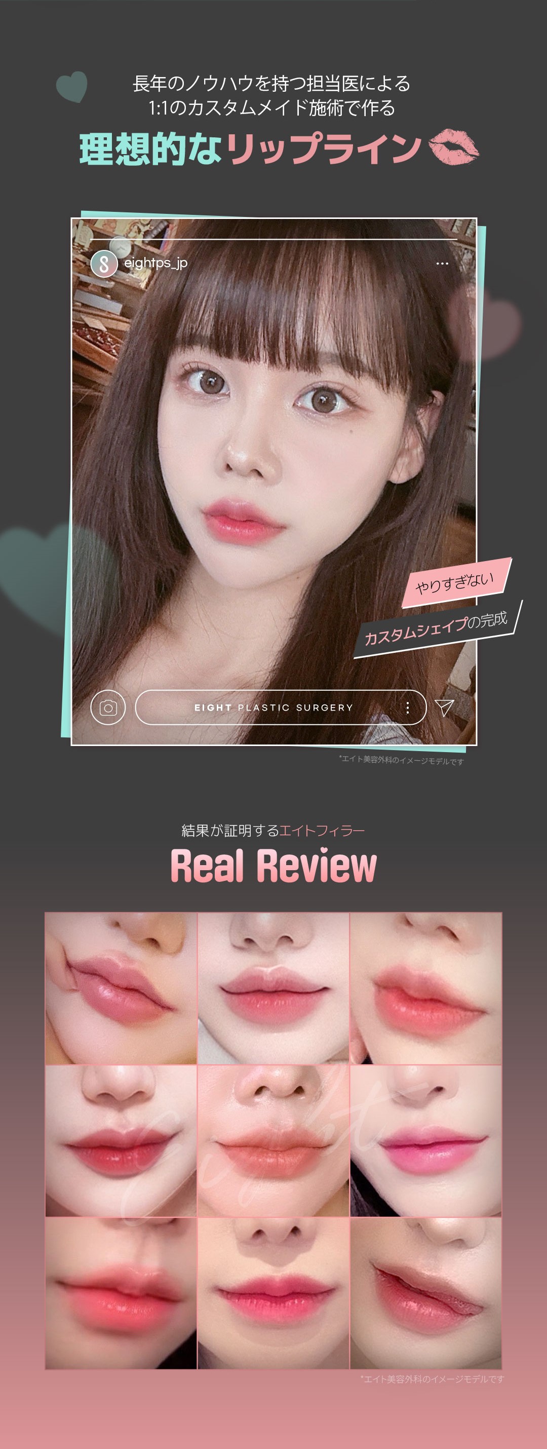 All Lip Filler Phẫu thuật Thẩm mỹ Eight Hàn Quốc｜Chăm sóc toàn diện môi + khóe miệng + Botox hướng đến đường môi lý tưởng｜Cách ga Apgujeong 5 phút đi bộ