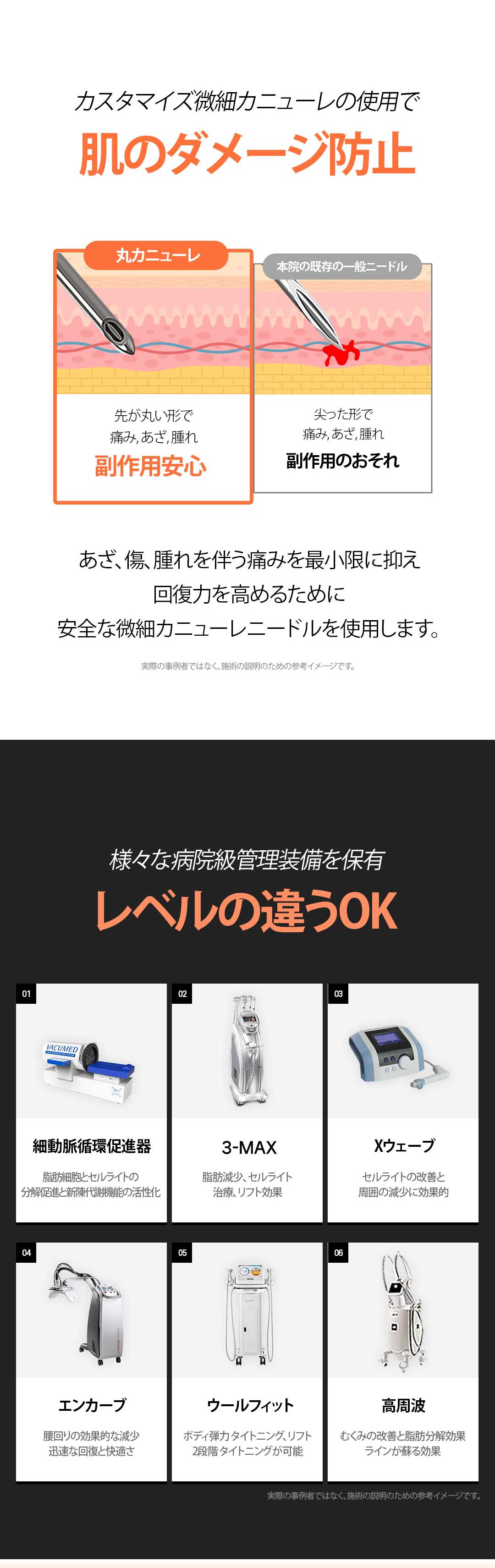 Hút mỡ bụng dung lượng lớn tại OK Clinic Hàn Quốc | Ống hút siêu nhỏ coi trọng an toàn, giảm tổn thương | Seoul Gangnam