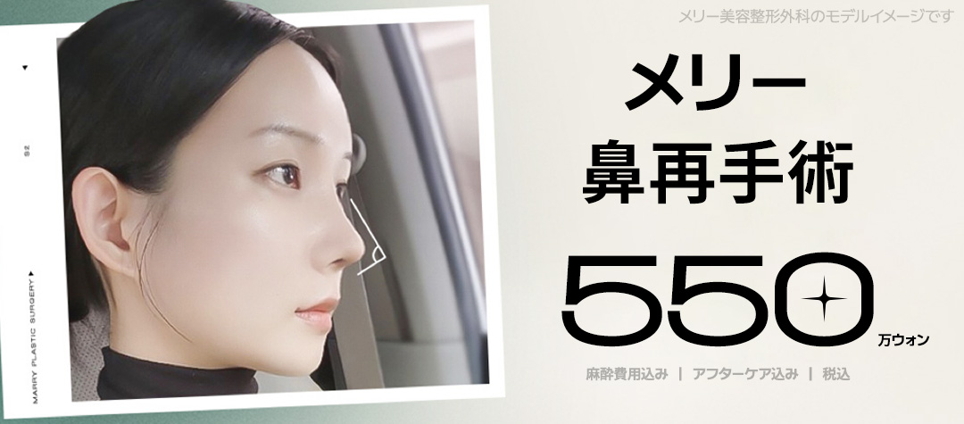 Merry Phẫu thuật lại mũi | Phẫu thuật chỉnh sửa tỉ mỉ giới hạn 1 ca/ngày với phân tích chính xác 3D-CT | Ga Apgujeong Merry Phẫu thuật Tạo hình Thẩm mỹ