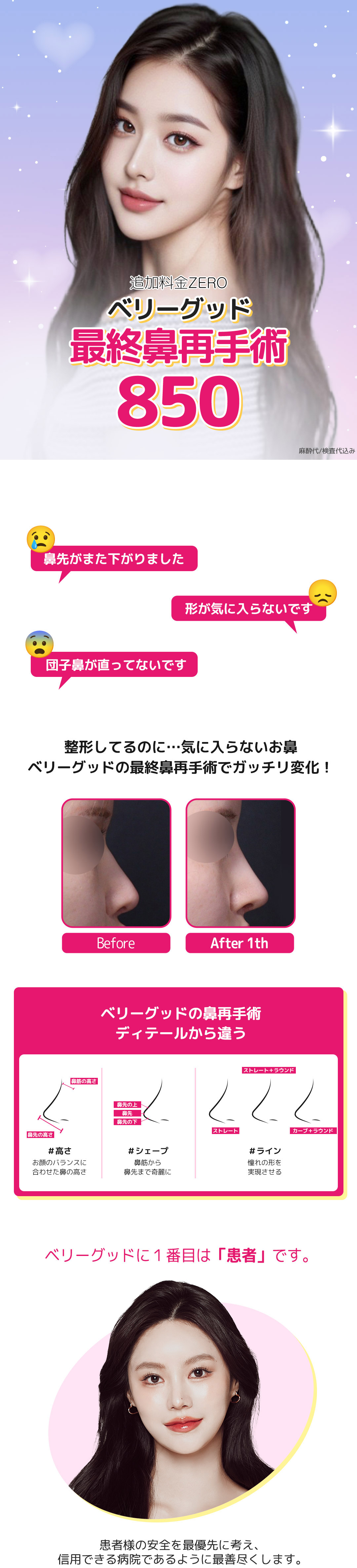 Phẫu thuật lại mũi tại Berry Good Phẫu thuật Thẩm mỹ Gangnam | Hướng tới đường nét mũi lý tưởng với chẩn đoán chính xác 3D-CT | Không phụ phí 8.500.000 won