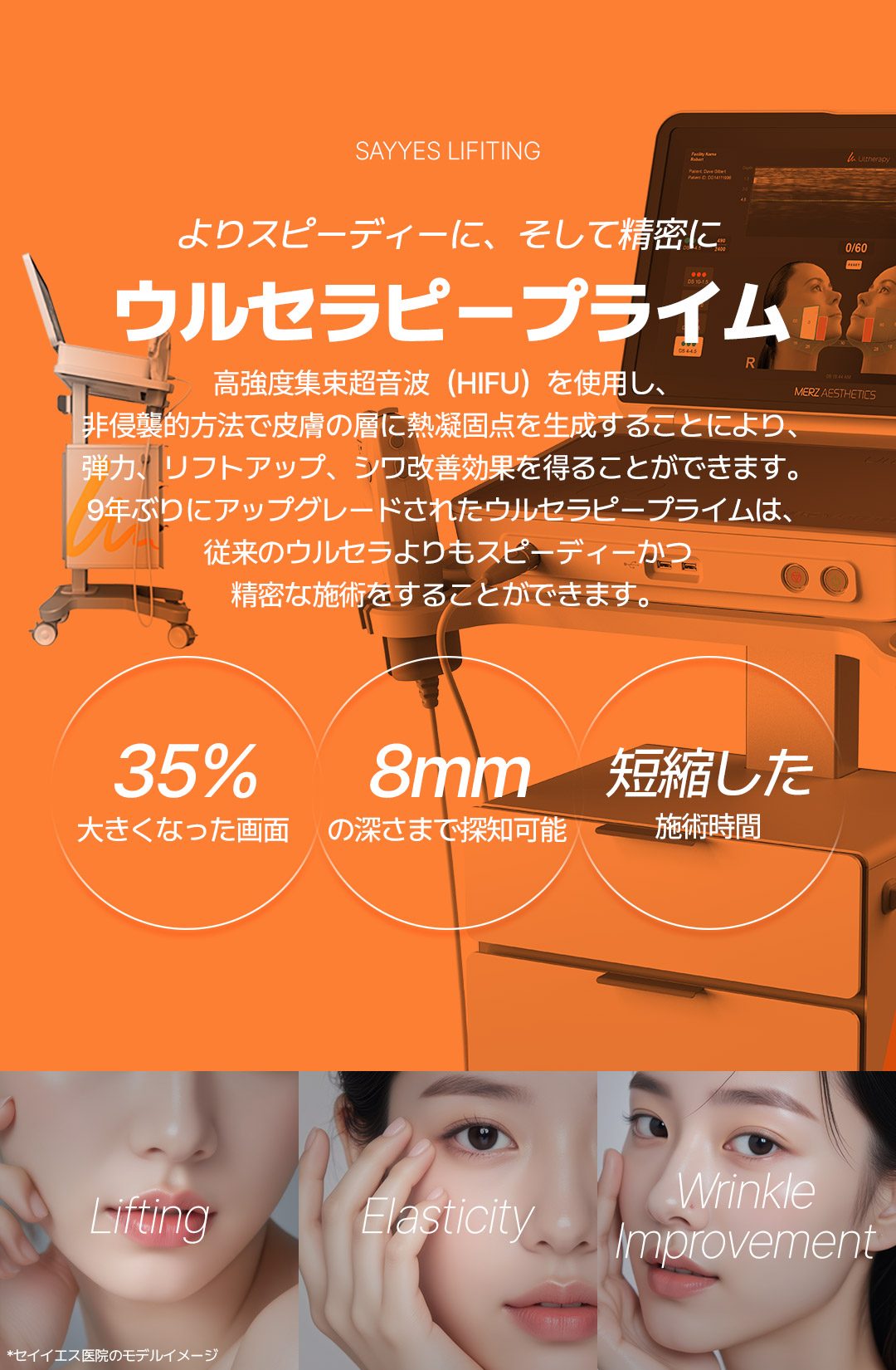 Ultherapy Prime 300 shot | Nâng cơ FDA | Say Yes Clinic Gangnam