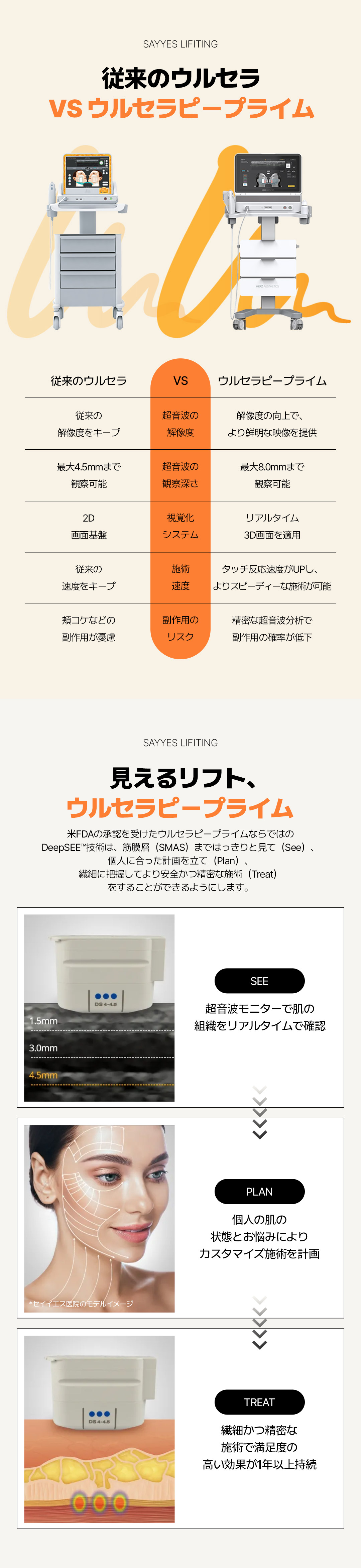 Ultherapy Prime 300 shot | Nâng cơ FDA | Say Yes Clinic Gangnam