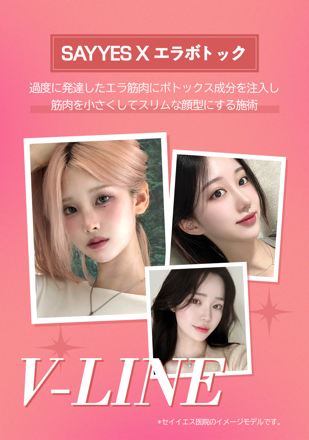 Tiêm tan mỡ đường viền + Botox hàm hướng đến gọn mặt V-line｜Từ 3.930 yên｜Phòng khám Say Yes｜Gangnam Hàn Quốc