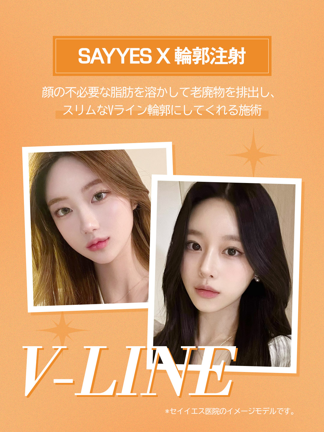 Tiêm tan mỡ đường viền + Botox hàm hướng đến gọn mặt V-line｜Từ 3.930 yên｜Phòng khám Say Yes｜Gangnam Hàn Quốc