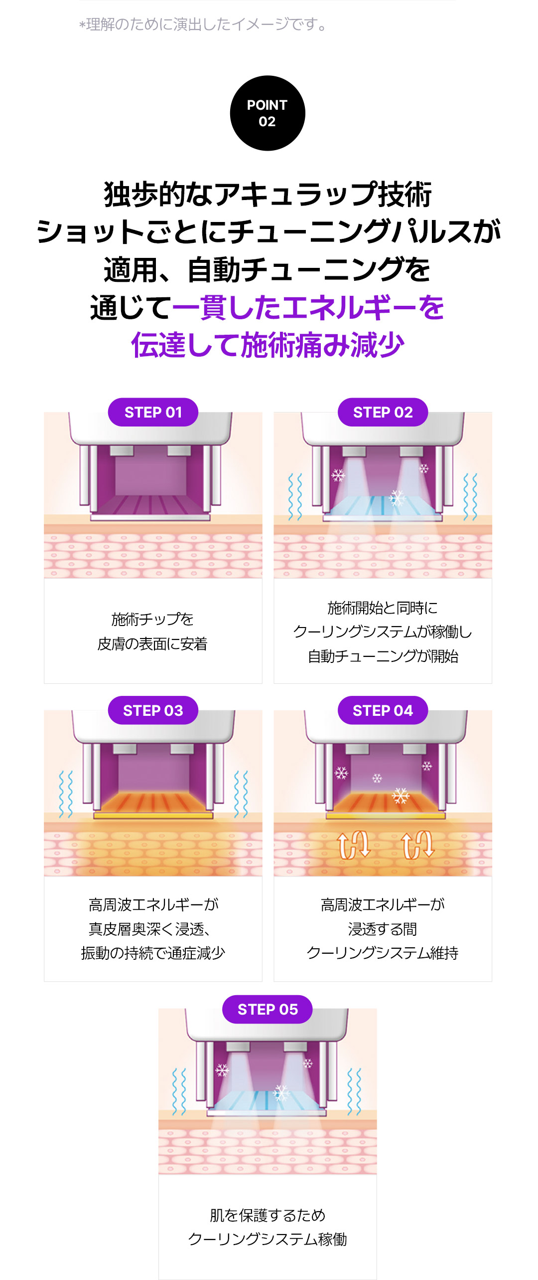 Thermage FLX thế hệ 4 Lifting｜300 Shot｜Chăm sóc chảy xệ, nếp nhăn với thiết bị được FDA chứng nhận｜Viện Sayyes Gangnam Seoul