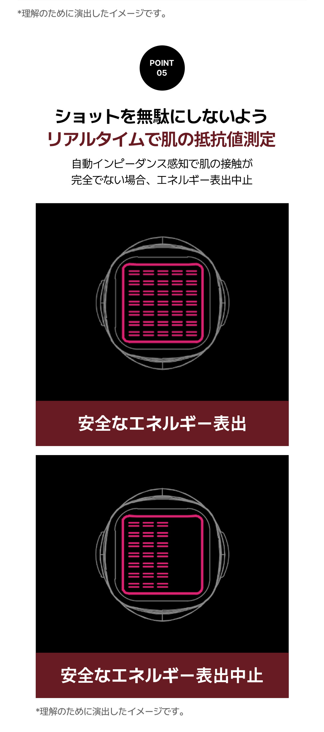 Volnewma Lift 300 Shot | RF Lifting giảm đau chăm sóc độ đàn hồi da | Say Yes Clinic