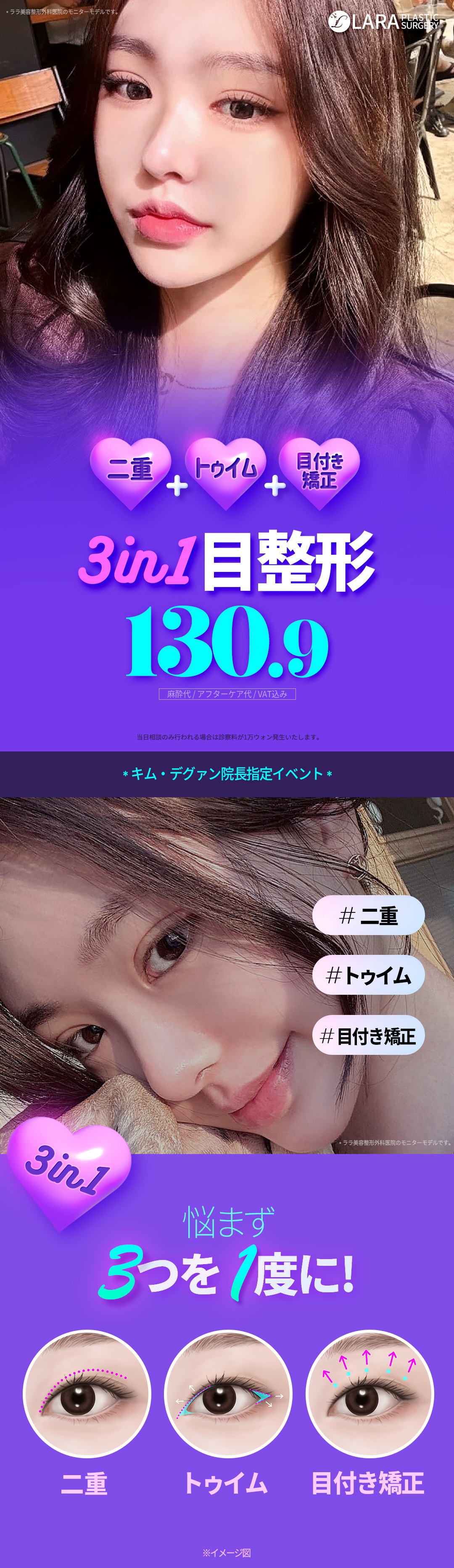 【Gangnam Hàn Quốc】Gói phẫu thuật mắt 3in1 (Mí đôi + Cắt đầu mắt + Điều chỉnh sụp mí) | Bác sĩ chuyên khoa tốt nghiệp ĐH Seoul thực hiện | Lala Thẩm mỹ