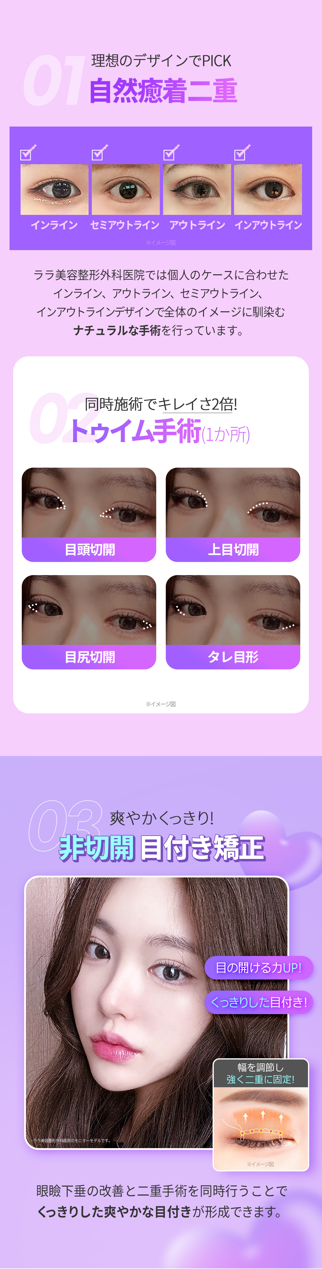 【Gangnam Hàn Quốc】Gói phẫu thuật mắt 3in1 (Mí đôi + Cắt đầu mắt + Điều chỉnh sụp mí) | Bác sĩ chuyên khoa tốt nghiệp ĐH Seoul thực hiện | Lala Thẩm mỹ