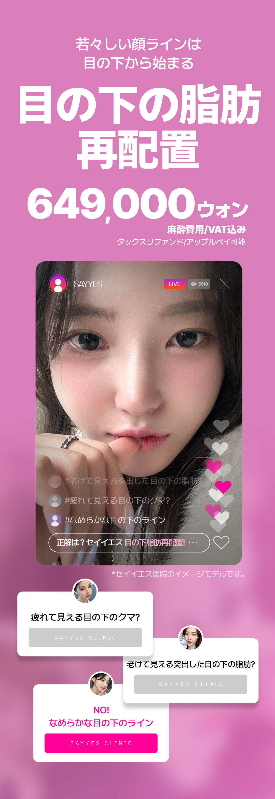 Tái phân bổ mỡ dưới mắt tạo ấn tượng trẻ trung | Giữ túi mắt, kết quả tự nhiên | Say Yes Gangnam