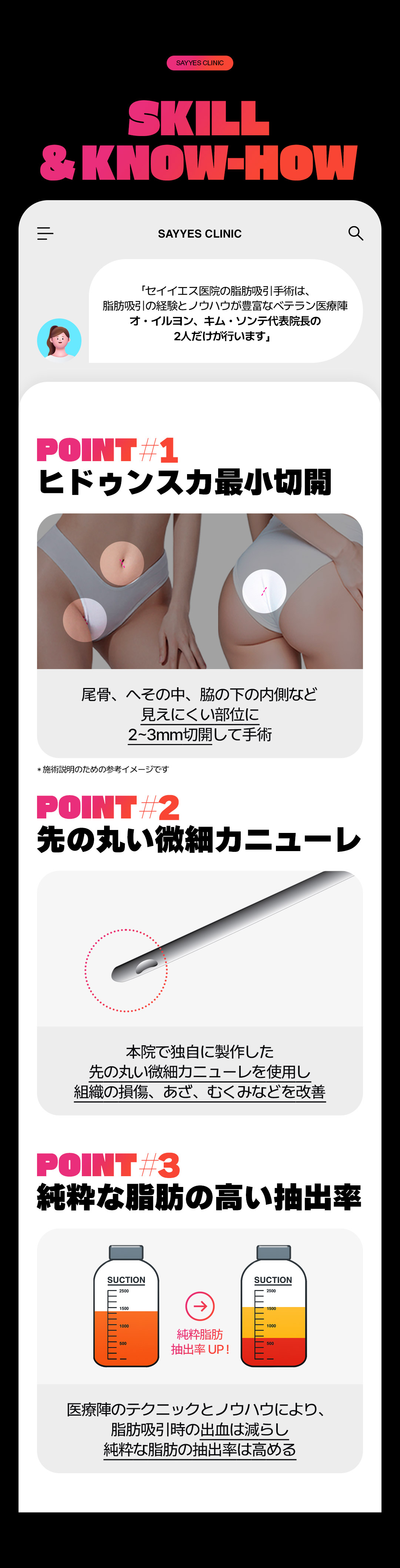 Hút mỡ đùi 360 độ tạo đường chân lý tưởng | Bác sĩ kỳ cựu phẫu thuật | Say Yes