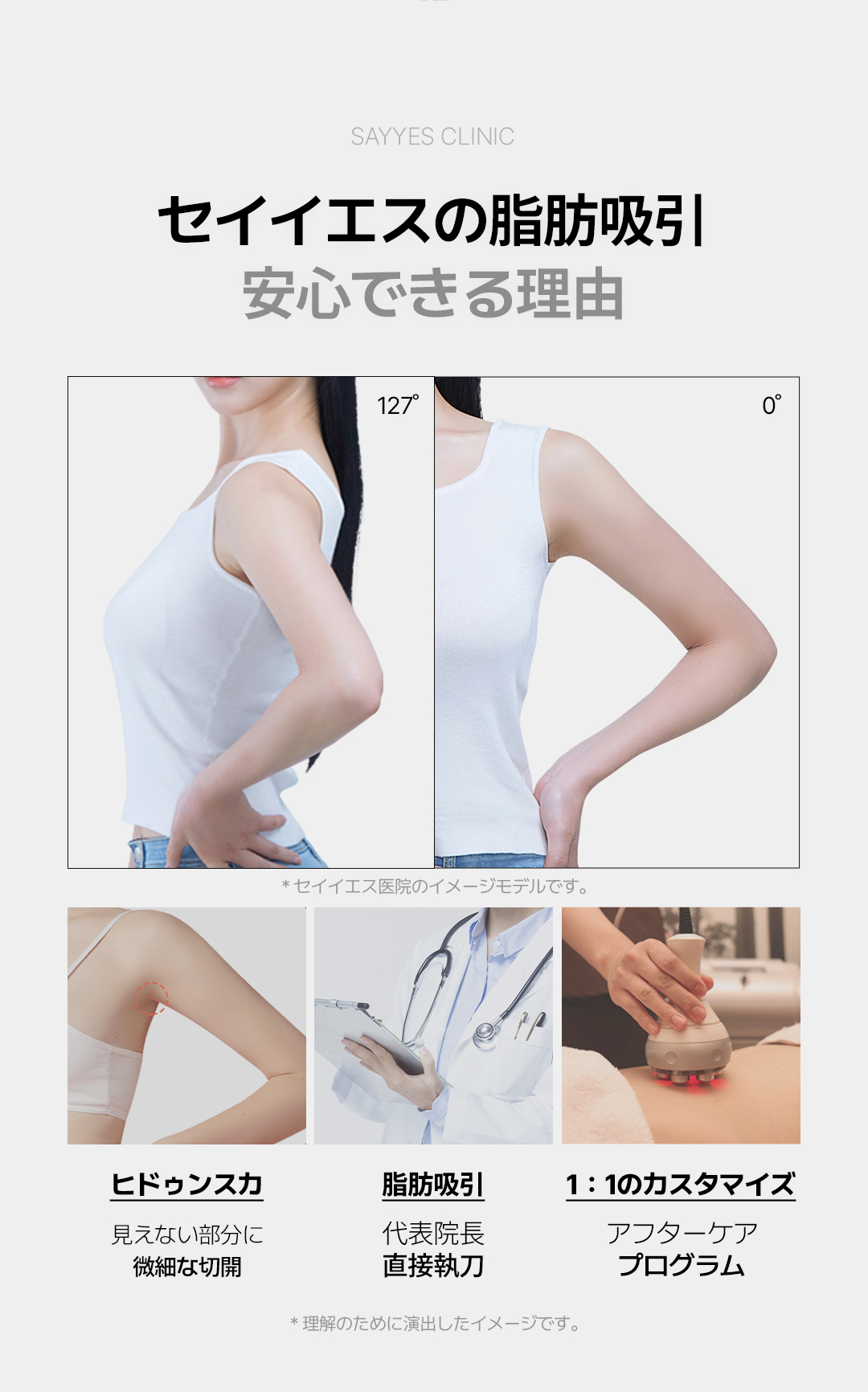 Hút mỡ bắp tay 360 độ | 2 bác sĩ trưởng đại diện trực tiếp thực hiện an tâm | Say Yes Clinic - Seoul Gangnam