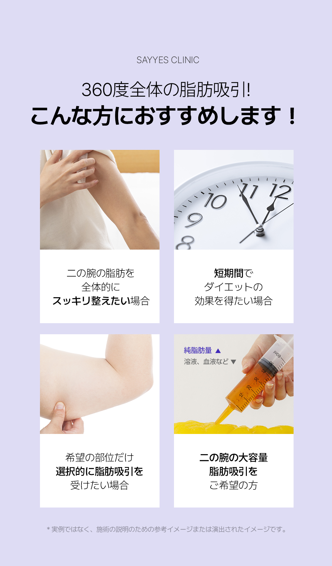 Hút mỡ bắp tay 360 độ | 2 bác sĩ trưởng đại diện trực tiếp thực hiện an tâm | Say Yes Clinic - Seoul Gangnam