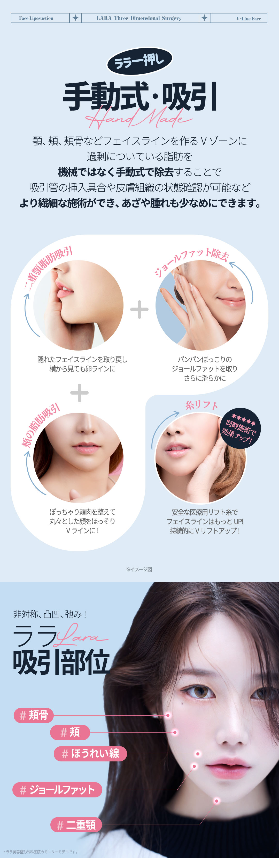 Hút mỡ mặt tạo V-line tự nhiên｜Thủ thuật tinh tế bằng phương pháp hút thủ công｜Lala Plastic Surgery ga Gangnam