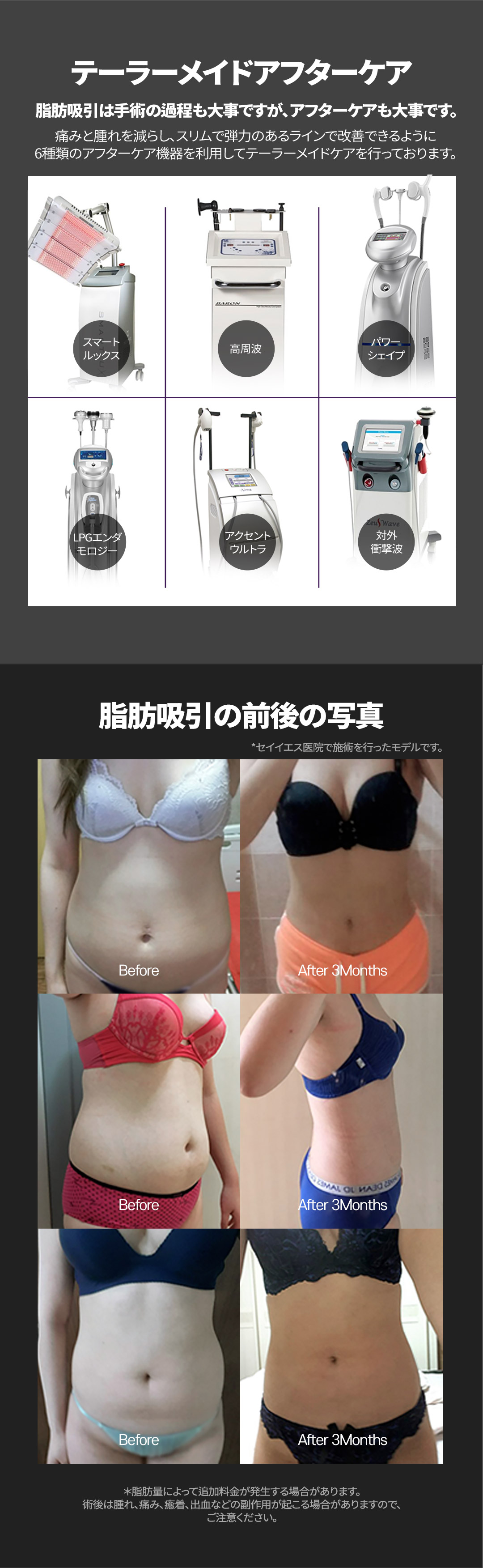 Hút mỡ bụng Say Yes Clinic Seoul | Y tế thẩm mỹ Hàn Quốc hướng đến body line lý tưởng với 6 loại thiết bị chăm sóc sau đầy đủ