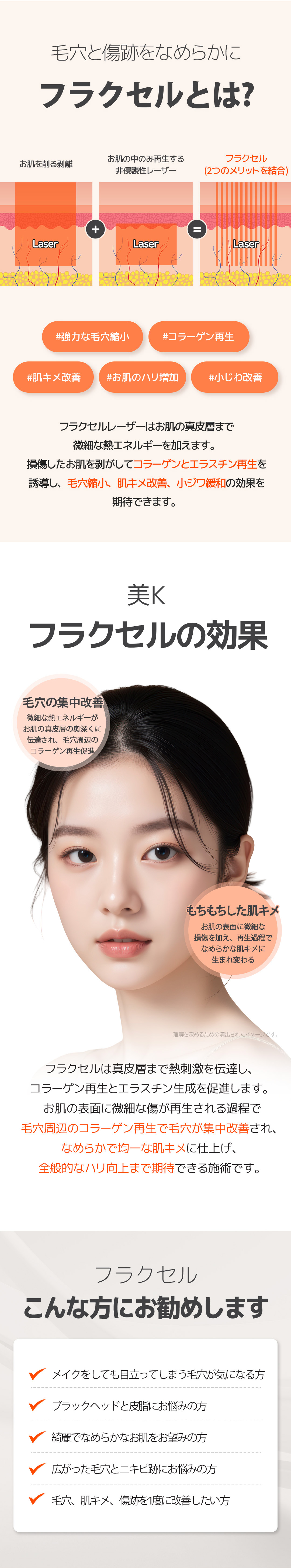 Chăm sóc lỗ chân lông・vết sẹo mụn với Laser Fraxel | Từ 5.716 yên~ | Seoul ga Gangnam Phòng khám Mikei | Hỗ trợ tiếng Nhật