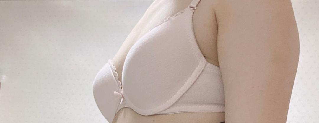 Phẫu thuật nâng ngực Hàn Quốc | Very Good Plastic Surgery kết nối trực tiếp ga Gangnam | Thẩm mỹ nâng ngực chú trọng an toàn với bác sĩ chuyên khoa thường trực